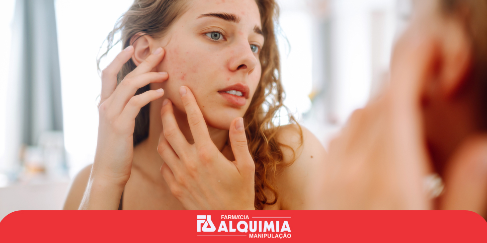 Acnever Black Alquimia: O Suplemento Revolucionário no Combate à Acne
